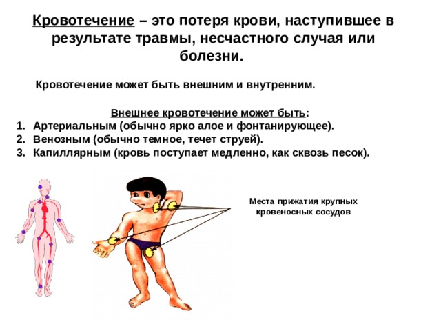 Кровотечение – это потеря крови, наступившее в результате травмы, несчастного случая или болезни. Кровотечение может быть внешним и внутренним. Внешнее кровотечение может быть : Артериальным (обычно ярко алое и фонтанирующее). Венозным (обычно темное, течет струей). Капиллярным (кровь поступает медленно, как сквозь песок).  Места прижатия крупных  кровеносных сосудов 