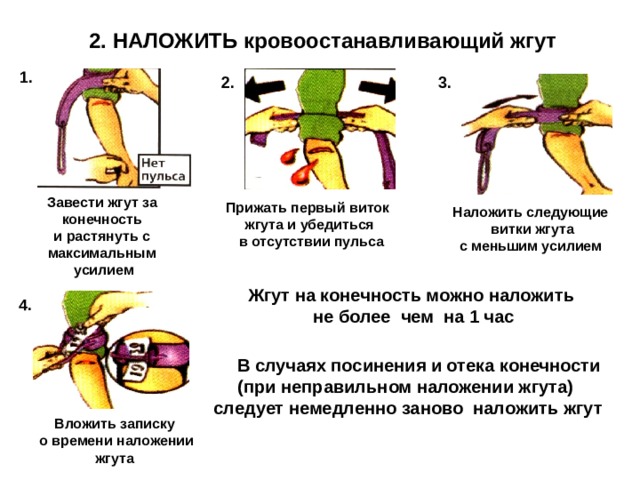 2. НАЛОЖИТЬ кровоостанавливающий жгут 1. 3. 2. Завести жгут за конечность и растянуть с максимальным  усилием Прижать первый виток жгута и убедиться  в отсутствии пульса Наложить следующие  витки жгута с меньшим усилием Жгут на конечность можно наложить  не более чем на 1 час 4.  В случаях посинения и отека конечности (при неправильном наложении жгута)  следует немедленно заново наложить жгут Вложить записку  о времени наложении жгута 