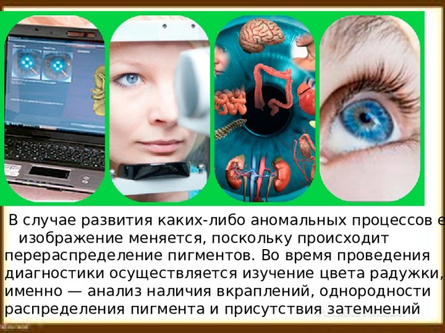  В случае развития каких-либо аномальных процессов ее изображение меняется, поскольку происходит перераспределение пигментов. Во время проведения диагностики осуществляется изучение цвета радужки, а именно — анализ наличия вкраплений, однородности распределения пигмента и присутствия затемнений 