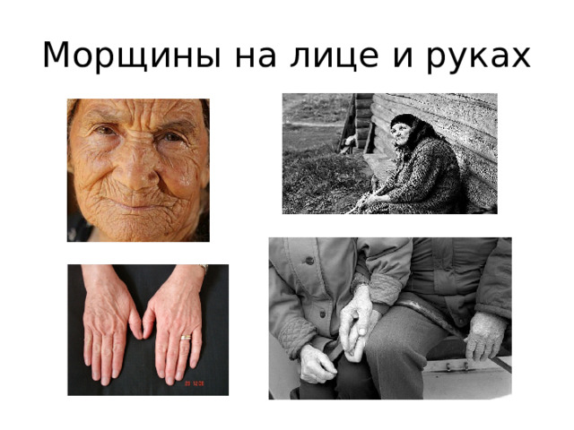 Морщины на лице и руках 