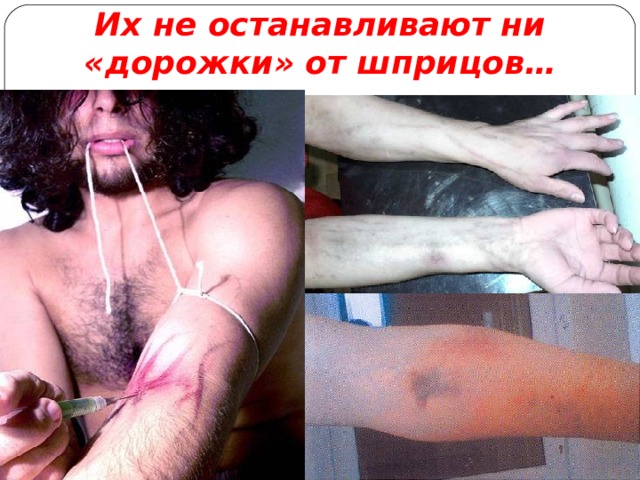Их не останавливают ни « дорожки » от шприцов… 