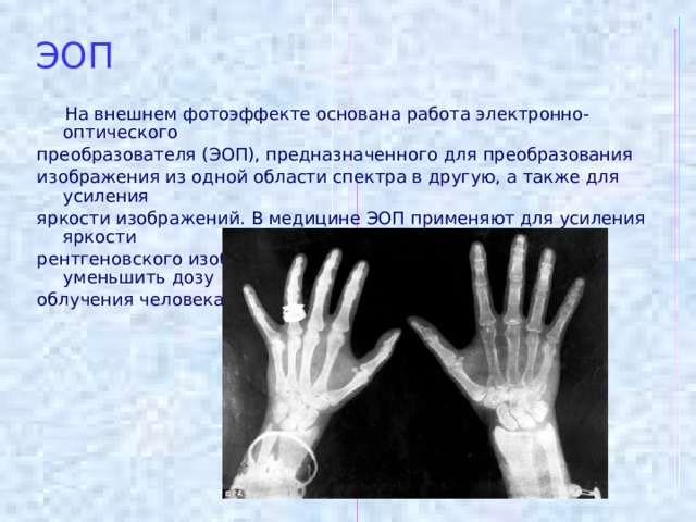 ЭОП  На внешнем фотоэффекте основана работа электронно-оптического преобразователя (ЭОП), предназначенного для преобразования изображения из одной области спектра в другую, а также для усиления яркости изображений. В медицине ЭОП применяют для усиления яркости рентгеновского изображения, это позволяет значительно уменьшить дозу облучения человека. 