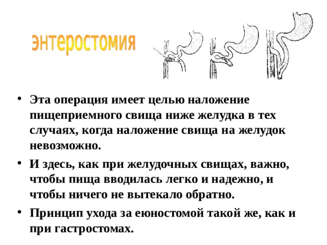 Эта операция имеет целью наложение  пищеприемного свища ниже желудка в тех случаях, когда наложение свища на желудок невозможно. И здесь, как при желудочных свищах, важно, чтобы пища вводилась легко и надежно, и чтобы ничего не вытекало обратно. Принцип ухода за еюностомой такой же, как и при гастростомах.  