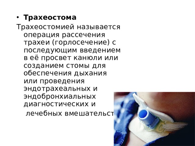 Трахеостома Трахеостомией называется операция рассечения трахеи (горлосечение) с последующим введением в её просвет канюли или созданием стомы для обеспечения дыхания или проведения эндотрахеальных и эндобронхиальных диагностических и  лечебных вмешательств. 