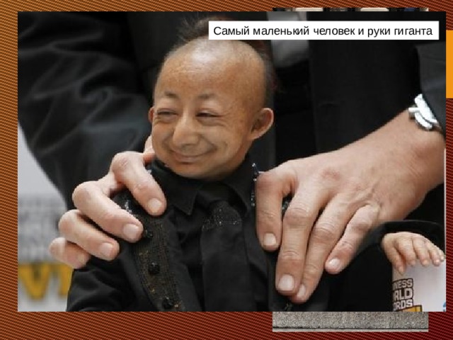 Самый маленький человек и руки гиганта  Китаец Хэ Пинпин родился с одной из разновидностей карликовости – его рост составляет всего 74,61 см. А самой длинноногой женщиной является наша соотечественница Светлана Панкратова, проживающая на данный момент в Испании. Светлане 36 лет и длина её ног – которые, к слову, Хэ назвал «очень красивыми» – составляет 1,32 м. 