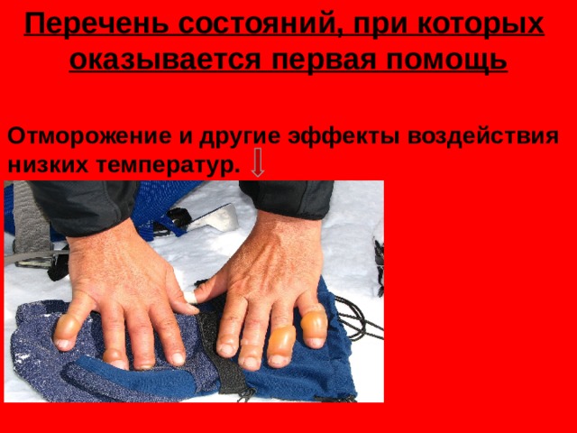 Перечень состояний, при которых   оказывается первая помощь   Отморожение и другие эффекты воздействия низких температур. 