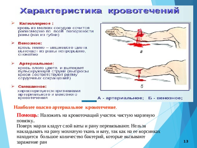  Наиболее опасно артериальное кровотечение . Помощь : Наложить на кровоточащий участок чистую марлевую повязку.. Поверх марли кладут слой ваты и рану перевязывают. Нельзя накладывать на рану мохнатую ткань и вату, так как на ее ворсинках находится большое количество бактерий, которые вызывают заражение ран  