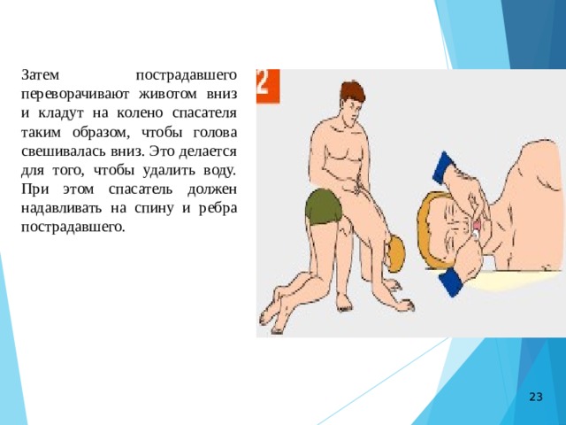 Затем пострадавшего переворачивают животом вниз и кладут на колено спасателя таким образом, чтобы голова свешивалась вниз. Это делается для того, чтобы удалить воду. При этом спасатель должен надавливать на спину и ребра пострадавшего. 23 