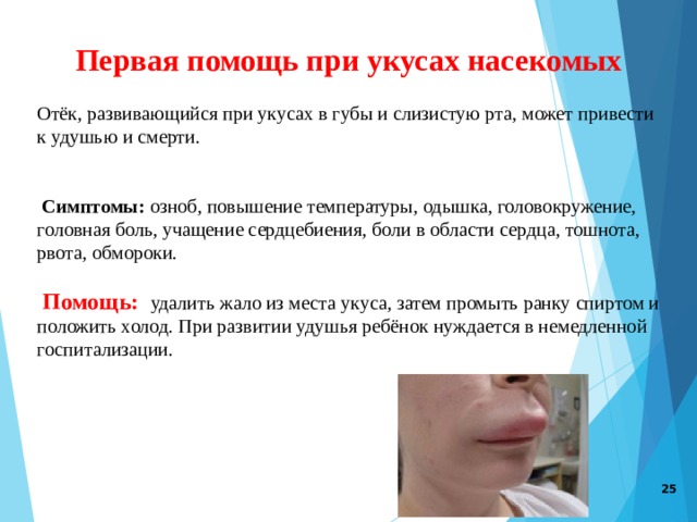 Первая помощь при укусах насекомых     Отёк, развивающийся при укусах в губы и слизистую рта, может привести к удушью и смерти.  Симптомы: озноб, повышение температуры, одышка, головокружение, головная боль, учащение сердцебиения, боли в области сердца, тошнота, рвота, обмороки.  Помощь: удалить жало из места укуса, затем промыть ранку спиртом и положить холод. При развитии удушья ребёнок нуждается в немедленной госпитализации.     