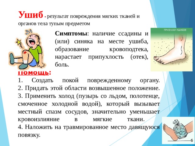 Ушиб - результат повреждения мягких тканей и органов тела тупым предметом Симптомы : наличие ссадины и (или) синяка на месте ушиба, образование кровоподтека, нарастает припухлость (отек), боль.  Помощь :  1. Создать покой поврежденному органу.  2. Придать этой области возвышенное положение.  3. Применить холод (пузырь со льдом, полотенце, смоченное холодной водой), который вызывает местный спазм сосудов, значительно уменьшает кровоизлияние в мягкие ткани.  4. Наложить на травмированное место давящуюся повязку.    