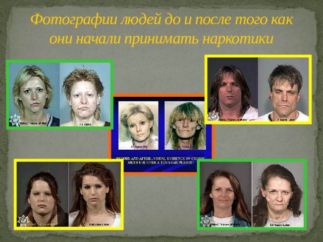 Фотографии людей до и после того как они начали принимать наркотики 