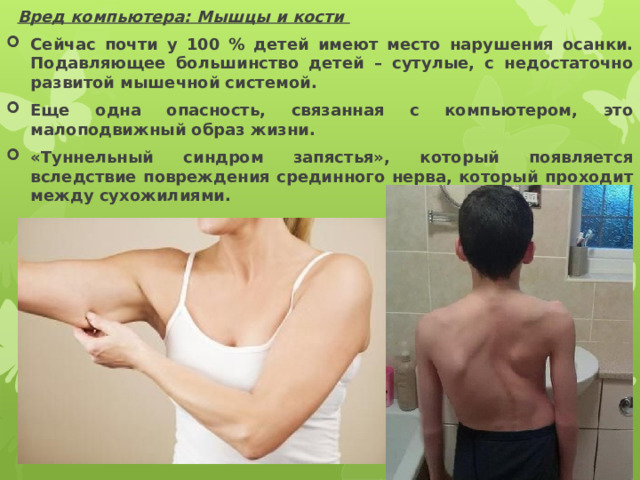  Вред компьютера: Мышцы и кости  Сейчас почти у 100 % детей имеют место нарушения осанки. Подавляющее большинство детей – сутулые, с недостаточно развитой мышечной системой. Еще одна опасность, связанная с компьютером, это малоподвижный образ жизни. «Туннельный синдром запястья», который появляется вследствие повреждения срединного нерва, который проходит между сухожилиями. 