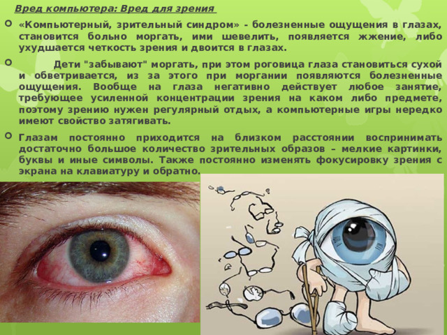  Вред компьютера: Вред для зрения «Компьютерный, зрительный синдром» - болезненные ощущения в глазах, становится больно моргать, ими шевелить, появляется жжение, либо ухудшается четкость зрения и двоится в глазах.  Дети 