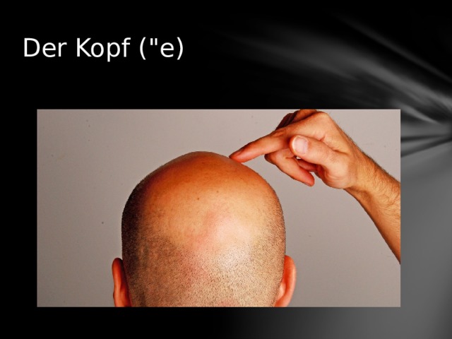 Der Kopf (