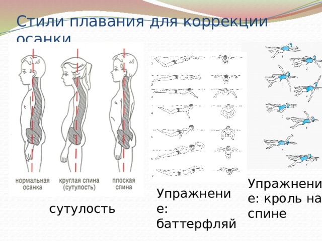 Стили плавания для коррекции осанки. Упражнение: кроль на спине Упражнение: баттерфляй сутулость 