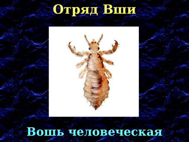 Отряд Вши Вошь человеческая 