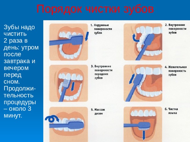 Порядок чистки зубов  Зубы надо чистить 2 раза в день: утром после завтрака и вечером перед сном. Продолжи-тельность процедуры – около 3 минут. 