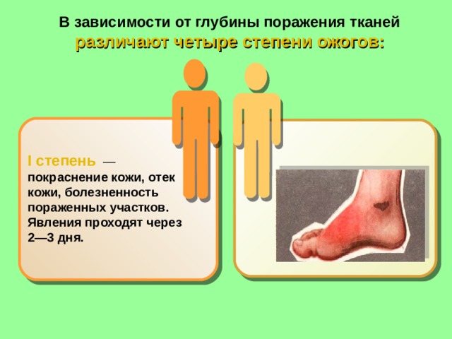 В зависимости от глубины поражения тканей различают четыре степени ожогов:   I степень   — покраснение кожи, отек кожи, болезненность пораженных участков. Явления проходят через 2—3 дня. 