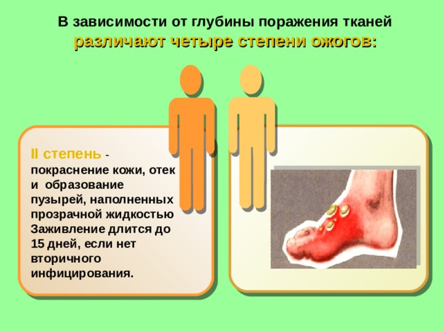 В зависимости от глубины поражения тканей различают четыре степени ожогов:   II степень  - покраснение кожи, отек и  образование пузырей, наполненных прозрачной жидкостью Заживление длится до 15 дней, если нет вторичного инфицирования. 