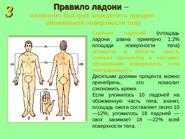 3 Правило ладони  –   позволяет быстрее определить процент  обожженной поверхности тела Сколько ладоней  (площадь ладони равна примерно 1,2% площади поверхности тела) уложится в область ожога, столько процентов и составит обожженная поверхность тела пострадавшего. Десятыми долями процента можно пренебречь, это позволит сэкономить время. Если уложилось 10 ладоней на обожженную часть тела, значит, площадь ожога составляет около 10—12%; уложилось 18 ладоней — ожог занимает 18 —22% всей поверхности тела.  