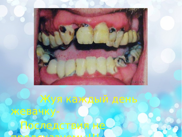  Жуя каждый день жевачку-  Последствия не предсказуемы!!! 