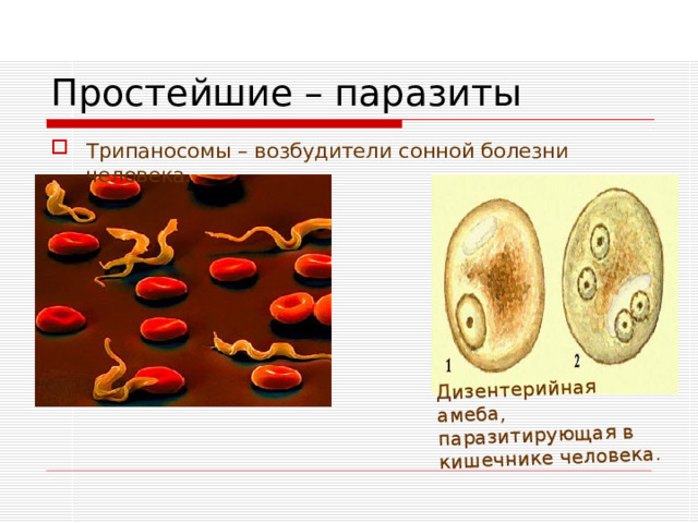 Дизентерийная амеба, паразитирующая в кишечнике человека. Простейшие – паразиты Трипаносомы – возбудители сонной болезни человека. 
