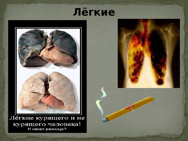Лёгкие    11 