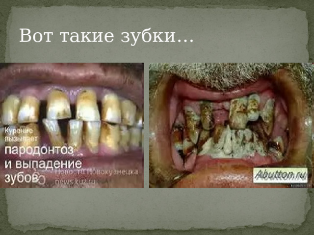 Вот такие зубки… 
