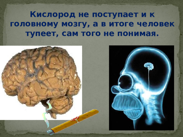 Кислород не поступает и к головному мозгу, а в итоге человек тупеет, сам того не понимая.      