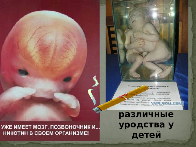 различные уродства у детей  