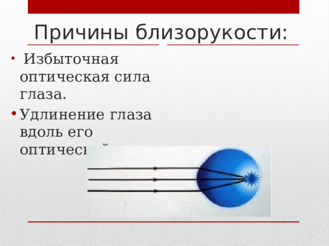 Причины близорукости:  Избыточная оптическая сила глаза. Удлинение глаза вдоль его оптической оси. 