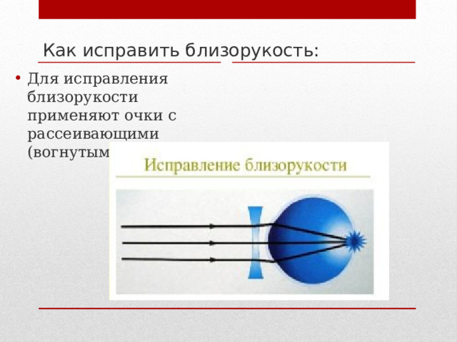 Как исправить близорукость: Для исправления близорукости применяют очки с рассеивающими (вогнутыми) линзами. 