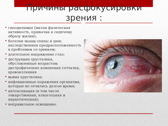 Причины расфокусировки зрения : гиподинамия (малая физическая активность, привычка к сидячему образу жизни); болезни мышц спины и шеи; наследственная предрасположенность к проблемам со зрением; длительное напряжение глаз; деструкции хрусталика, обусловленные возрастом; дистрофические изменения сетчатки, кровоизлияния вывих хрусталика; инфекционные поражения организма, которые не лечились долгое время; интоксикация (в том числе лекарственная, алкогольная и наркотическая); неправильное освещение. 