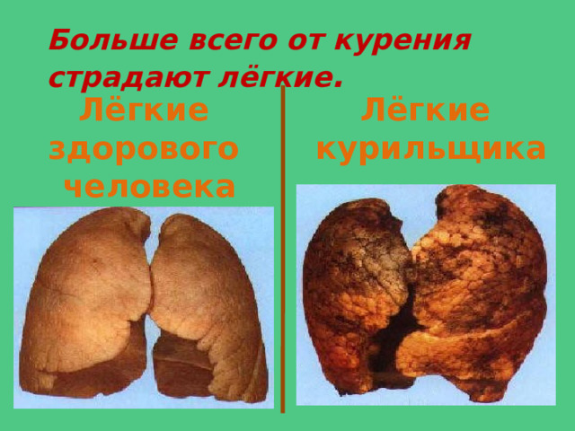 Больше всего от курения страдают лёгкие . Лёгкие здорового Лёгкие  человека курильщика 