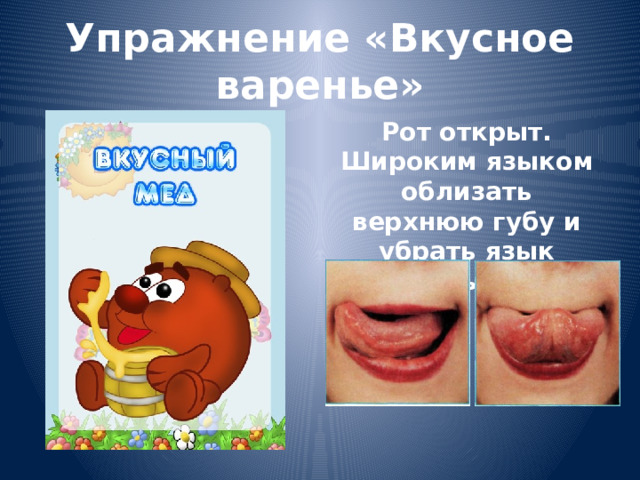 Упражнение «Вкусное варенье» Рот открыт. Широким языком облизать верхнюю губу и убрать язык вглубь рта. 