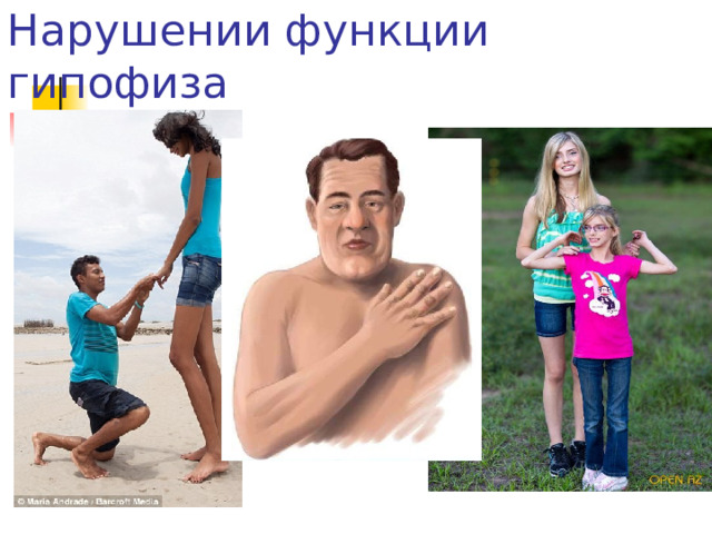 Нарушении функции гипофиза 