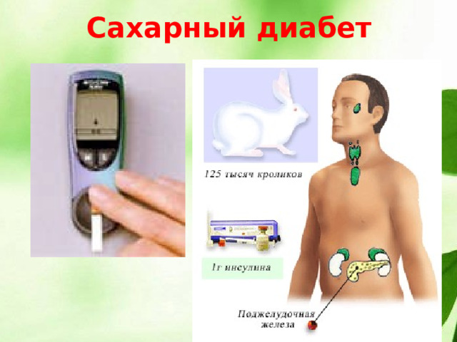 Сахарный диабет 