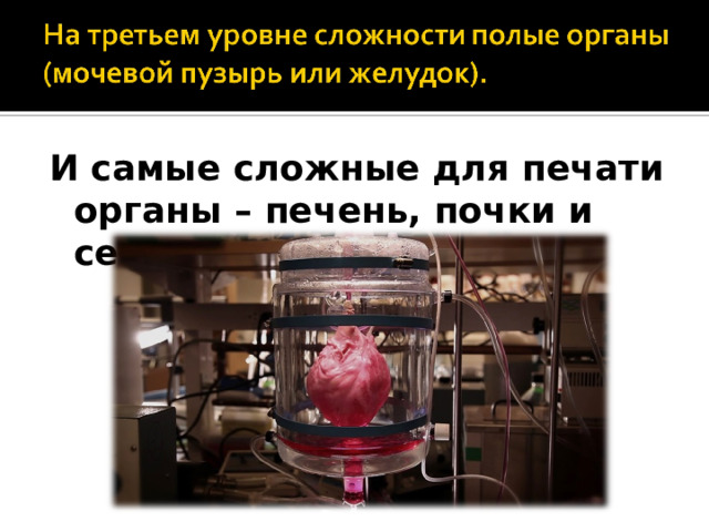 И самые сложные для печати органы – печень, почки и сердце. 