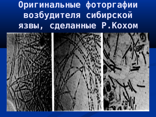 Оригинальные фоторгафии возбудителя сибирской язвы, сделанные Р.Кохом 