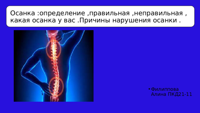 Осанка :определение ,правильная ,неправильная ,какая осанка у вас .Причины нарушения осанки . Филиппова Алина ПКД21-11 