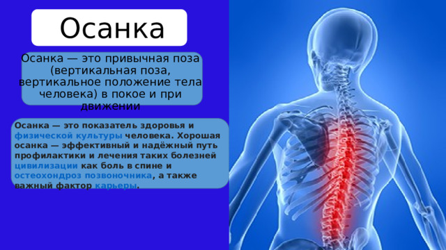 Осанка Осанка — это привычная поза (вертикальная поза, вертикальное положение тела человека) в покое и при движении Осанка — это показатель  здоровья  и  физической культуры  человека. Хорошая осанка — эффективный и надёжный путь профилактики и лечения таких болезней  цивилизации  как боль в спине и  остеохондроз позвоночника , а также важный фактор  карьеры . 