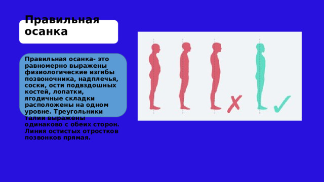 Правильная осанка Правильная осанка- это равномерно выражены физиологические изгибы позвоночника, надплечья, соски, ости подвздошных костей, лопатки, ягодичные складки расположены на одном уровне. Треугольники талии выражены одинаково с обеих сторон. Линия остистых отростков позвонков прямая. 