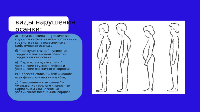 виды нарушения осанки: а) ” круглая спина ” – увеличение грудного кифоза на всем протяжении грудного отдела позвоночника- кифотическая осанка ; б) ” вогнутая спина ” – усиление лордоза в поясничной области- лордотическая осанка; в). ” кругло-вогнутая спина ” – увеличение грудного кифоза и увеличение поясничного лордоза; г) ” плоская спина ” – сглаживание всех физиологических изгибов; д) ” плоско-вогнутая спина ” – уменьшение грудного кифоза при нормальном или несколько увеличенном поясничном лордозе. 