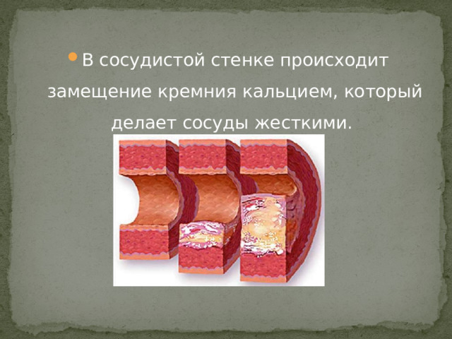 В сосудистой стенке происходит замещение кремния кальцием, который делает сосуды жесткими. 