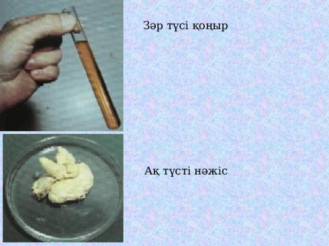 Зәр түсі қоңыр Ақ түсті нәжіс 