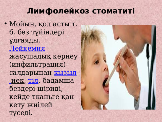 Лимфолейкоз стоматиті   Мойын, қол асты т. б. без түйіндері ұлғаяды. Лейкемия жасушалық кернеу (инфильтрация) салдарынан қызыл  иек , тіл , бадамша бездері шіриді, кейде тканьге қан кету жиілей түседі. 
