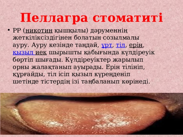 Пеллагра стоматиті РР ( никотин қышқылы) дәруменнің жеткіліксіздігінен болатын созылмалы ауру. Ауру кезінде таңдай, ұрт , тіл , ерін , қызыл  иек шырышты қабығында күлдіреуік бөртіп шығады. Күлдіреуіктер жарылып орны жалақтанып ауырады. Ерін тілініп, құрғайды, тіл ісіп қызыл күреңденіп шетінде тістердің ізі таңбаланып көрінеді. 