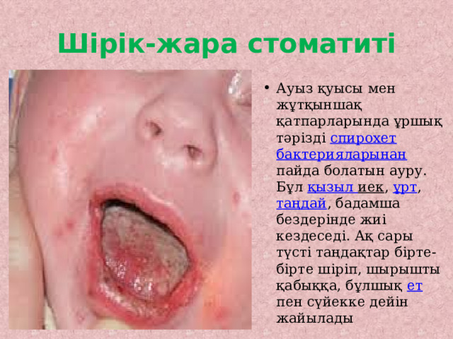 Шірік-жара стоматиті Ауыз қуысы мен жұтқыншақ қатпарларында ұршық тәрізді спирохет  бактерияларынан пайда болатын ауру. Бұл қызыл  иек , ұрт , таңдай , бадамша бездерінде жиі кездеседі. Ақ сары түсті таңдақтар бірте-бірте шіріп, шырышты қабыққа, бұлшық ет пен сүйекке дейін жайылады 