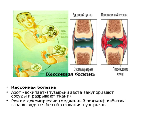 Кессонная болезнь Азот «вскипает»(пузырьки азота закупоривают сосуды и разрывают ткани) Режим декомпрессии (медленный подъем): избытки газа выводятся без образования пузырьков 
