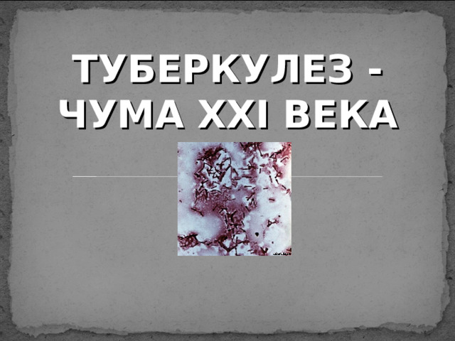 ТУБЕРКУЛЕЗ -ЧУМА ХХІ ВЕКА 